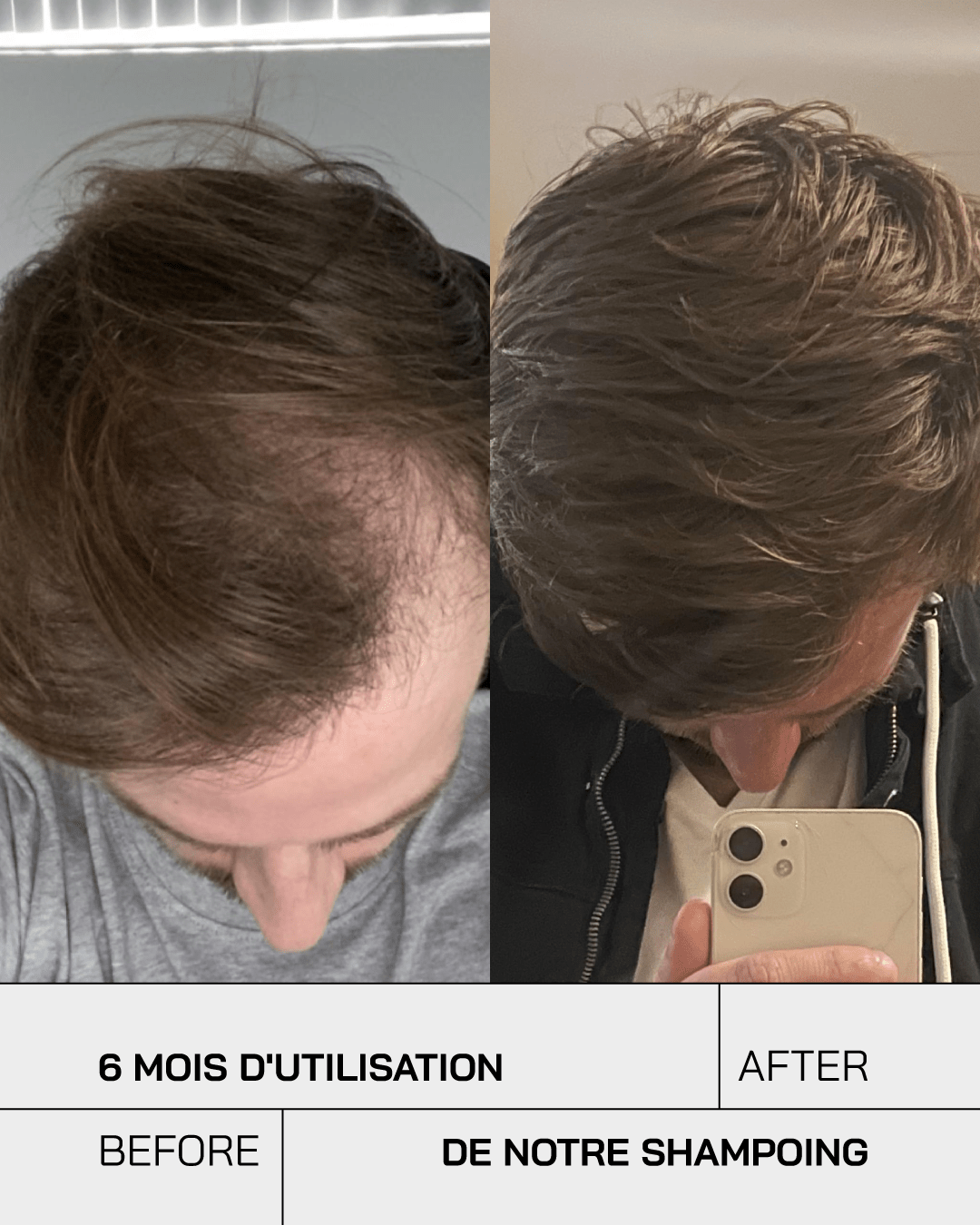 Shampoing Anti Chute