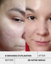 Sérum Niacinamide 10% + Zinc 1%