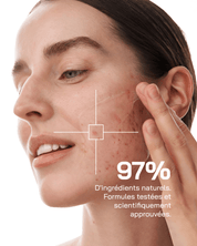 Sérum Niacinamide 10% + Zinc 1%