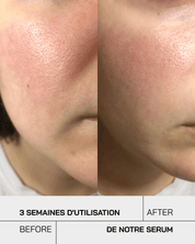 Sérum Niacinamide 10% + Zinc 1%