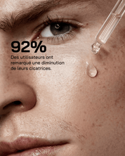 Sérum Niacinamide 10% + Zinc 1%