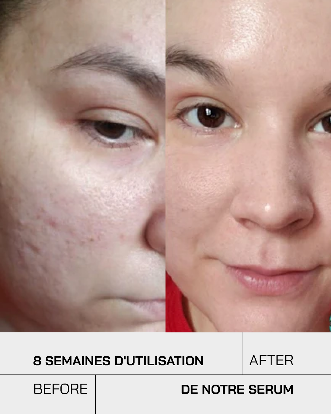 Sérum Niacinamide 10% + Zinc 1%