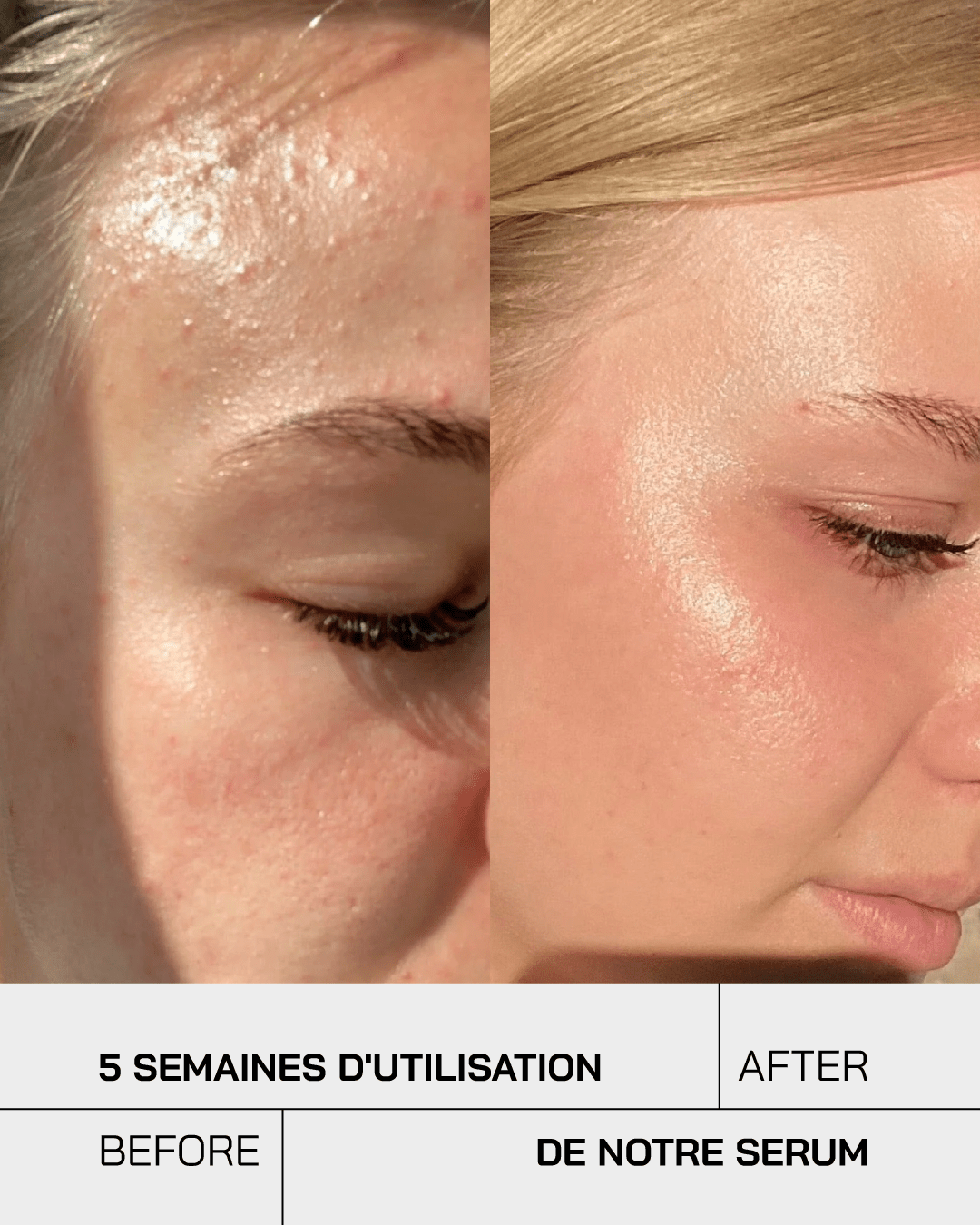 Sérum Niacinamide 10% + Zinc 1%