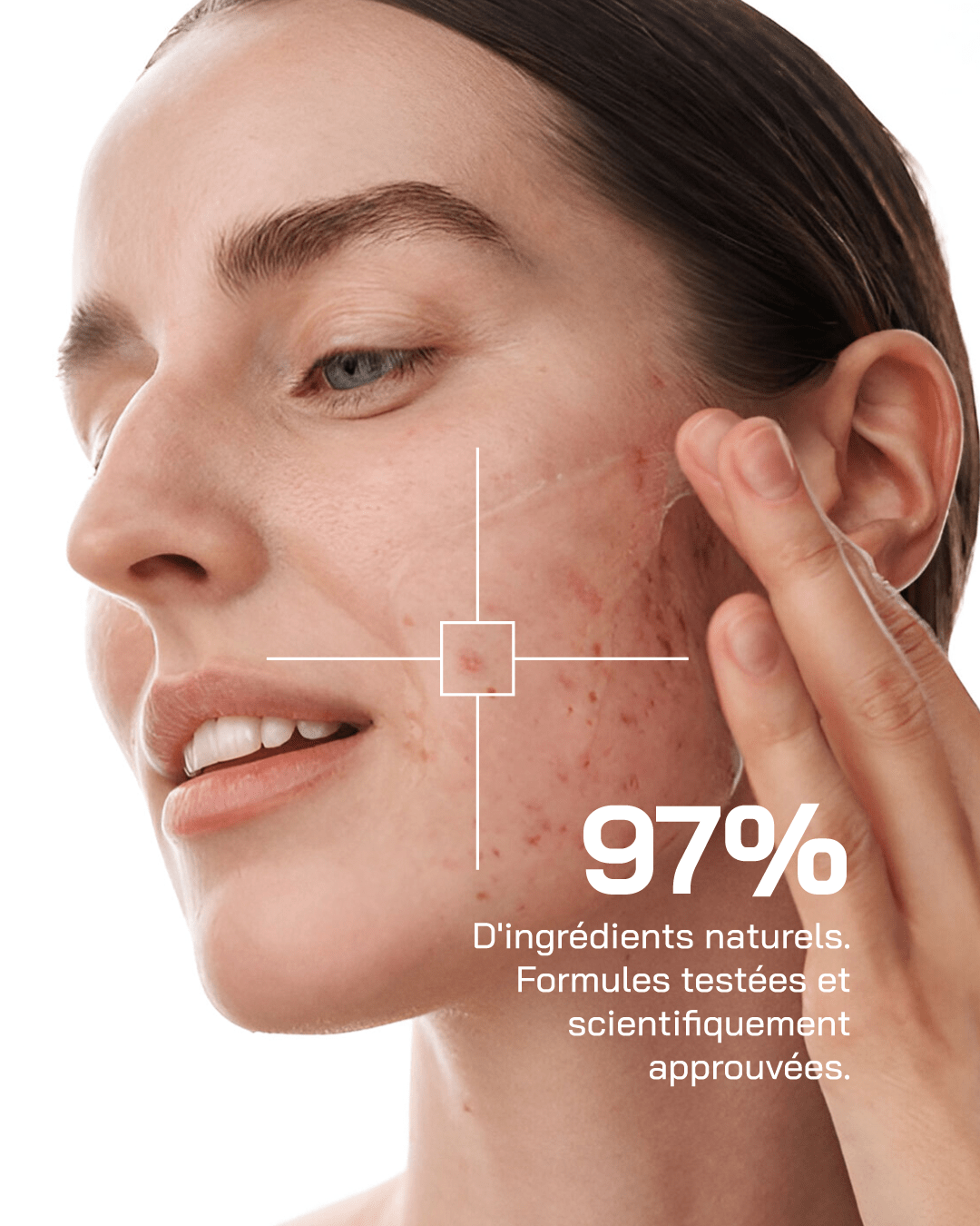 Sérum Niacinamide 10% + Zinc 1%