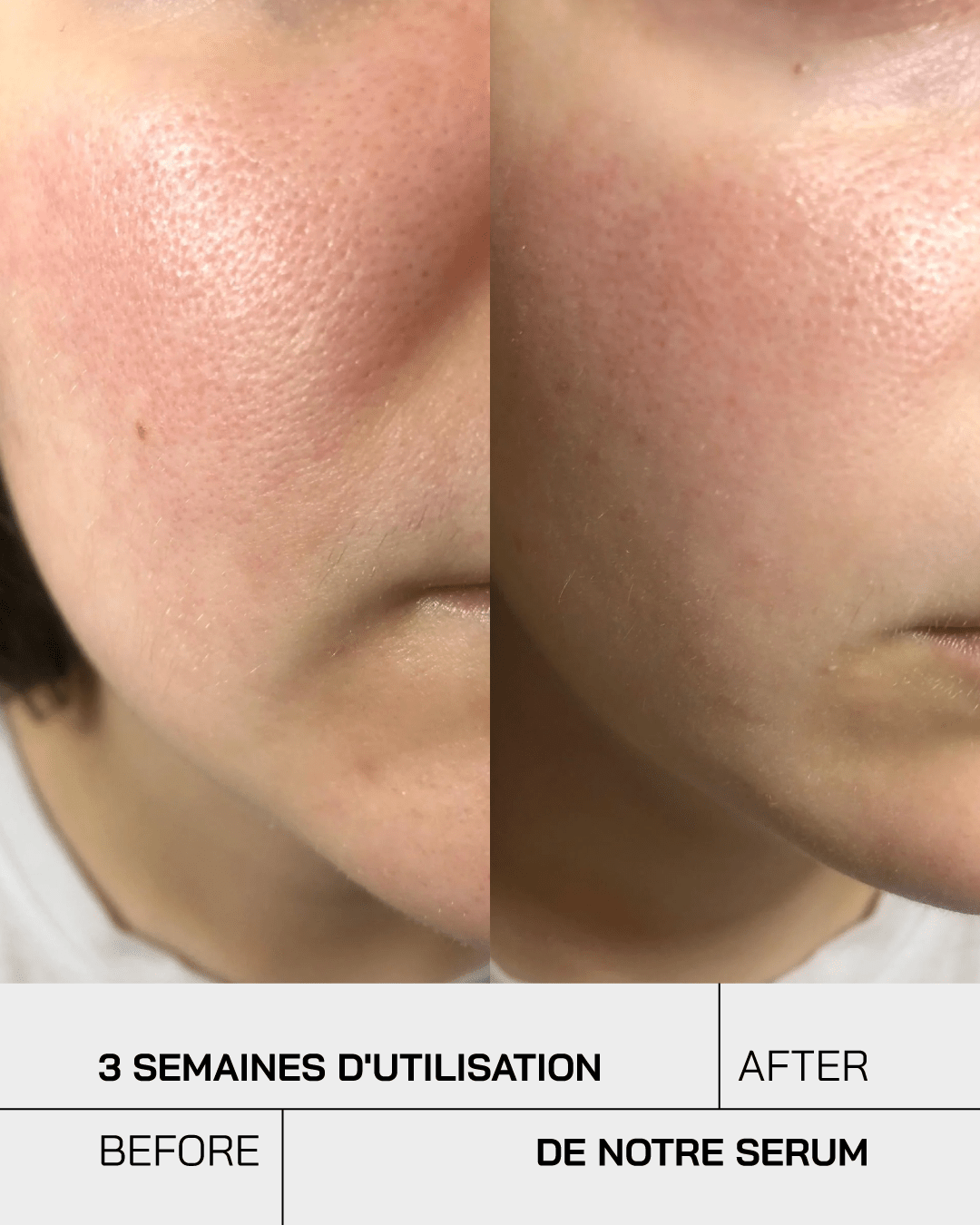 Sérum Niacinamide 10% + Zinc 1%