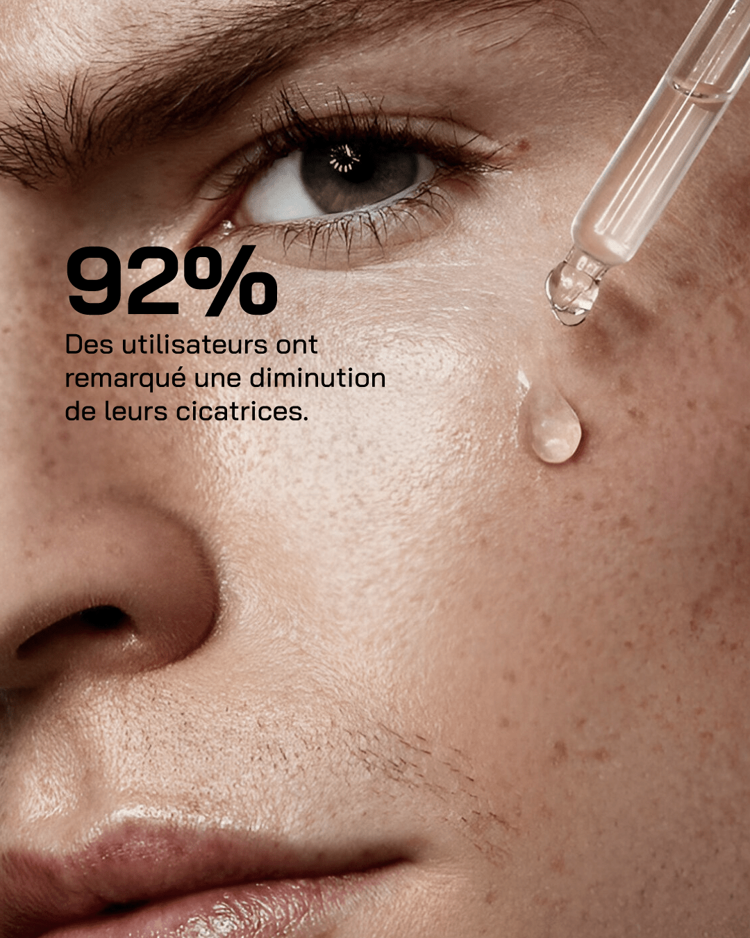 Sérum Niacinamide 10% + Zinc 1%